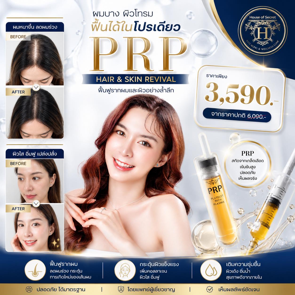 โปรแกรม PRP บำรุงผม