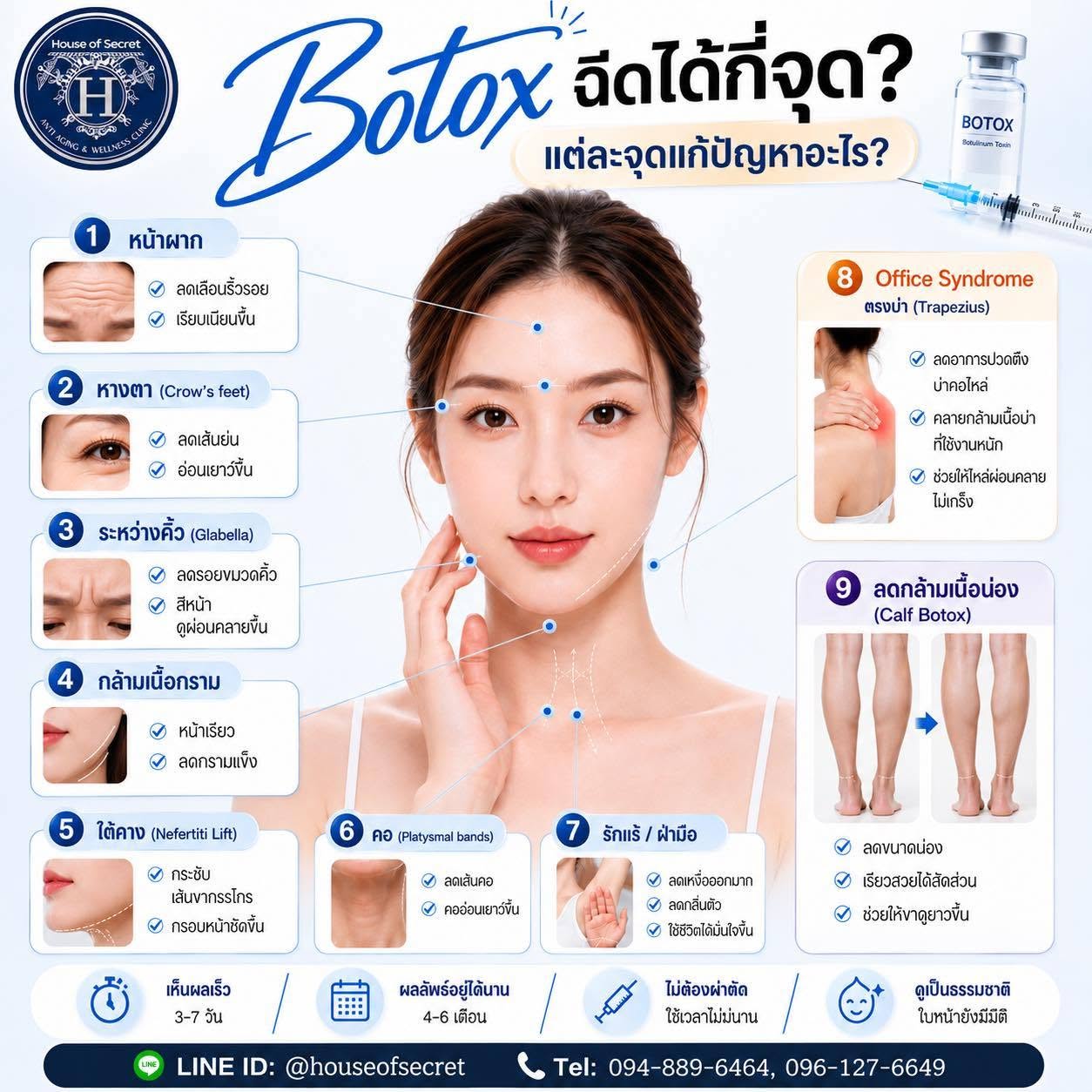 โปรแกรม Botox โบท็อกซ์ฉีดได้กี่จุด