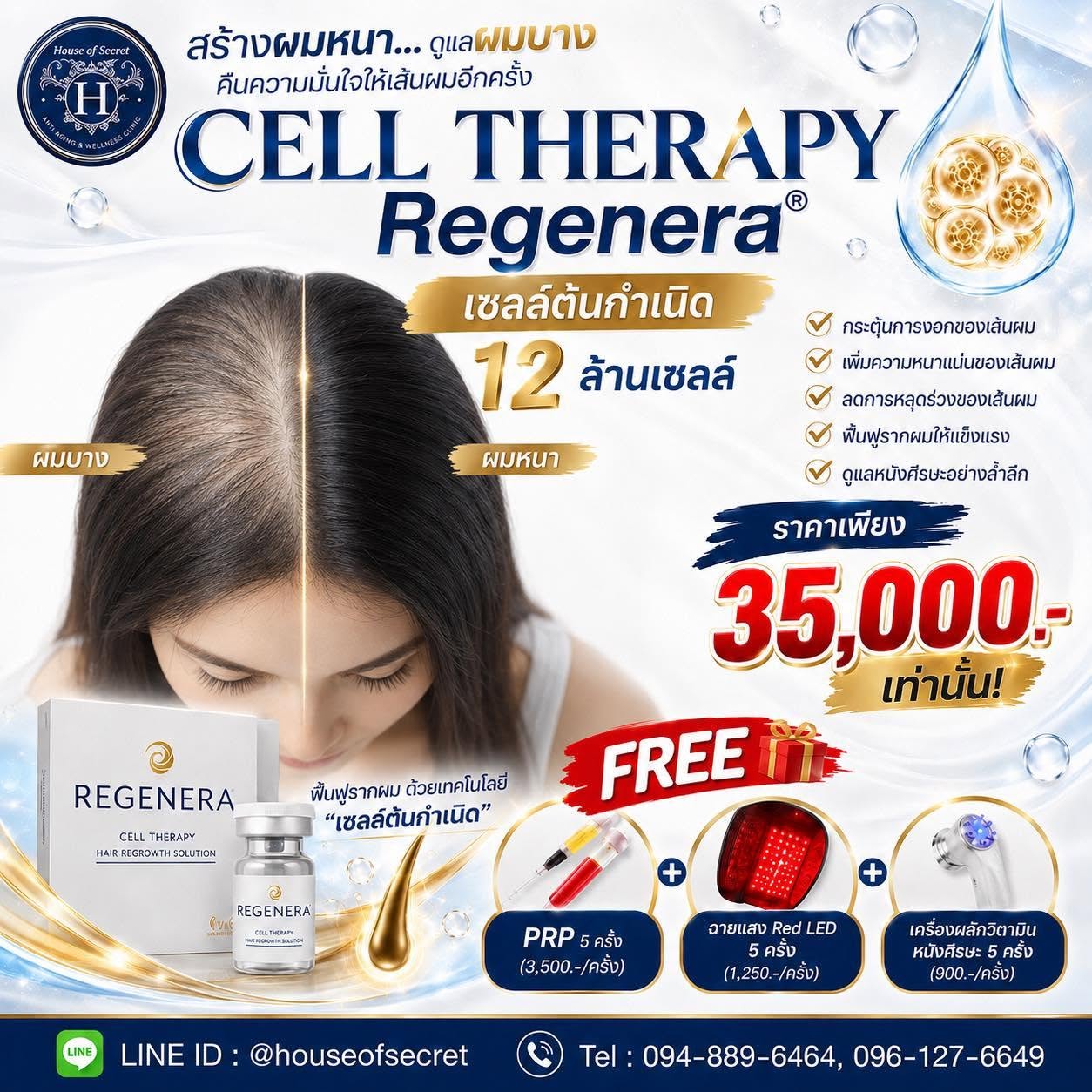 โปรแกรม CELL THERAPY Regenera ดูแลปัญหาผมบางและหนังศีรษะอย่างตรงจุด