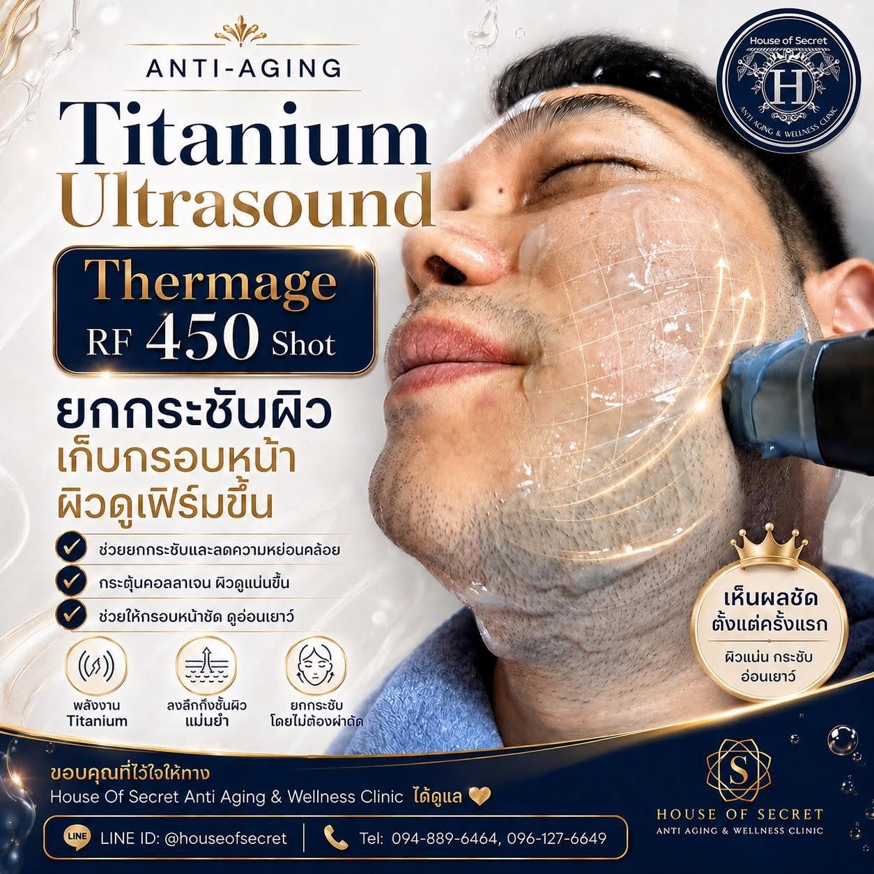 กรอบหน้าไม่ชัด แก้ได้ด้วยการยกกระชับแบบตรงจุด!