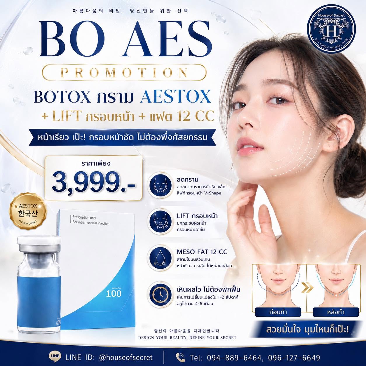 หน้าเรียว กรอบชัด จัดครบในโปรเดียว! ใครรู้สึกกรามเด่น กรอบหน้าไม่ชัด เหนียงกวนใจ…โปรนี้คุ้มแบบไม่ต้องเลือก